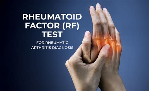 no rf reading|Rheumatoid factor .